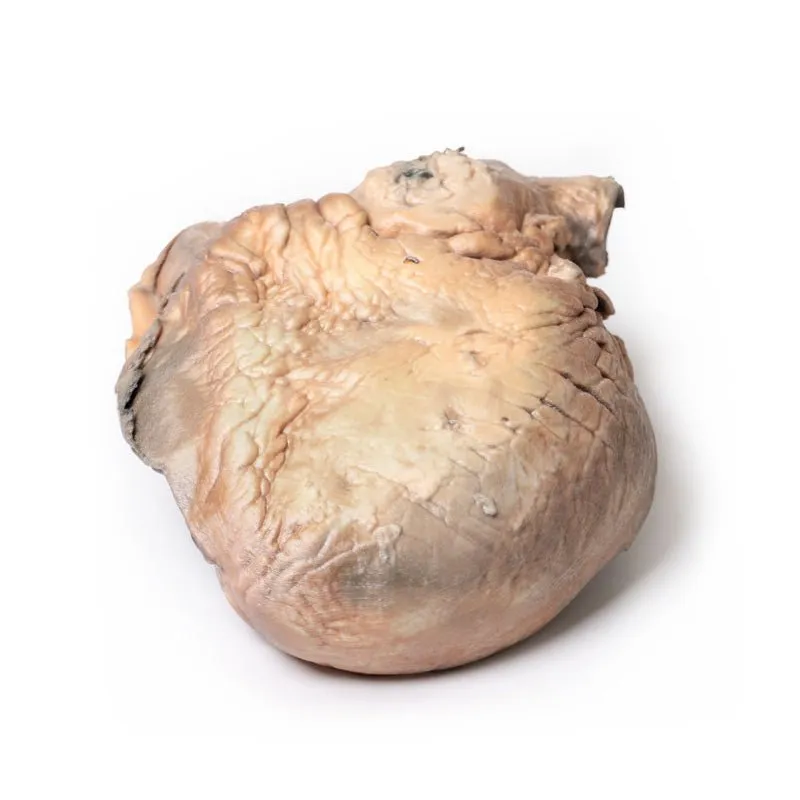 3D Printed Ruptured Thoracic Aortic Aneurysm